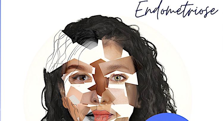 ENDOMÉTRIOSE - Un test salivaire analysé à Tercis dans les Landes